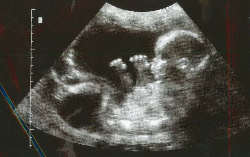 "Fear Not": 5 Reasons to Keep Your Unborn Baby