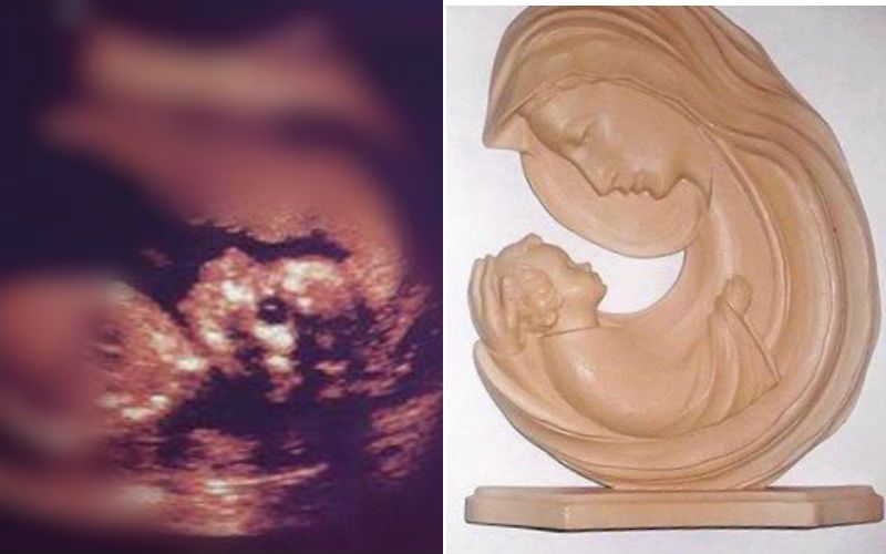 Miraculous Image of Blessed Mother Holding Baby Appears in Pregnancy Sonogram - See the Photo!