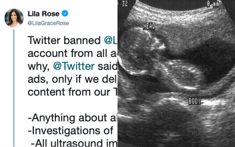 Twitter Says Live Action Must Delete Ultrasound Images, Pro-Life Content to Run Ads