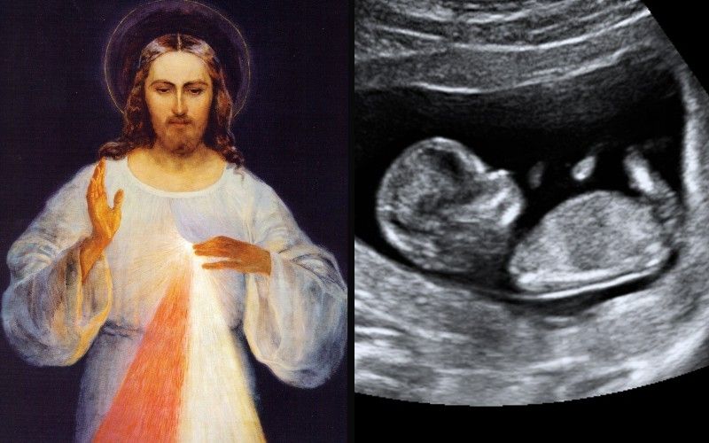 Is the Divine Mercy Chaplet Meant to End Abortion? Supernatural Clues in St. Faustina's Diary