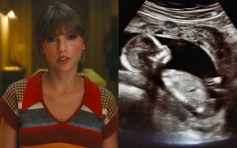 Taylor Swift's New Song Moves Mothers to Mourn Their Miscarried Babies