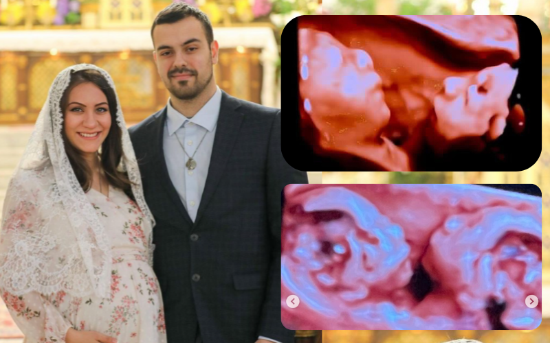 Catholic Mother Pregnant with Conjoined Twins Sharing One Heart - Her Inspiring Story